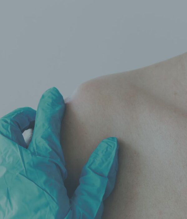 Luxação Acromioclavicular